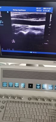 PH L12-5 Медицинская диагностика Ультразвуковой линейный зондирующий преобразователь для PH HD9 совместим